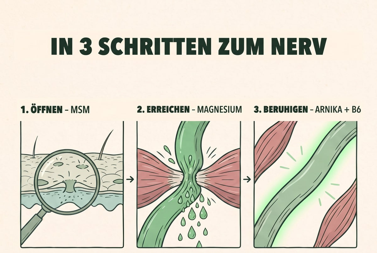 los ischiaspdp 3 schritte