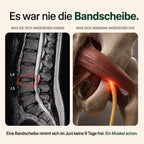 Es war nie die Bandscheibe – sondern ein Muskel, der den Nerv umklammert