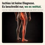 Ischias ist keine Diagnose – sondern eine Beschreibung, wo es wehtut