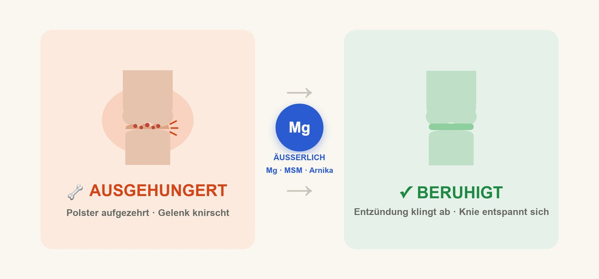 los knie infografik