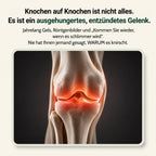 Knochen auf Knochen ist nicht die ganze Geschichte – es ist ein ausgehungertes, entzündetes Gelenk