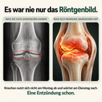 Es war nie nur das Röntgenbild – die Entzündung ist entscheidend