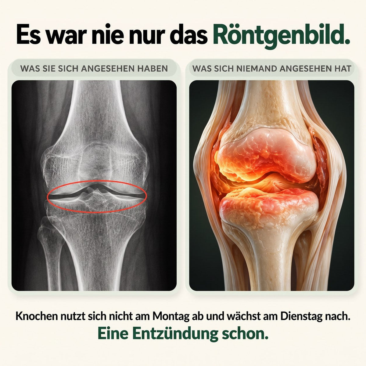 Es war nie nur das Röntgenbild – die Entzündung ist entscheidend